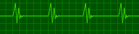 Heartbeat